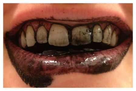Teeth- -Activated-Charcoal