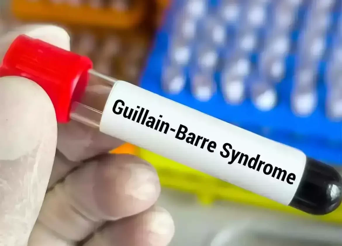 Guillain Barre Syndrome